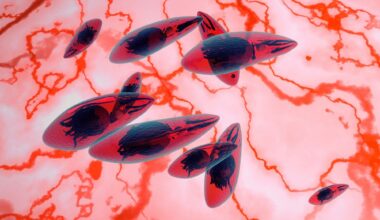 Review: Systematic review and modelling of Toxoplasma gondii seroprevalence in humans, Europe, 2000 to 2021. Image Credit: fotovapl / Shutterstock