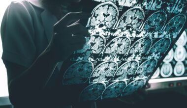 Study: Plasma Phosphorylated Tau 217 to Identify Preclinical Alzheimer Disease. Image Credit: Atthapon Raksthaput / Shutterstock