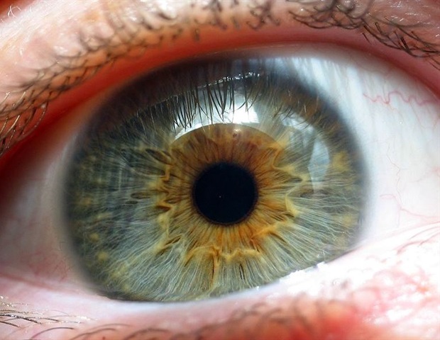New research aims to use eyedrops to lower lifetime risk of nearsightedness complications