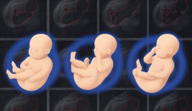 Machine-learning tool gives doctors a more detailed 3D picture of fetal health | MIT News