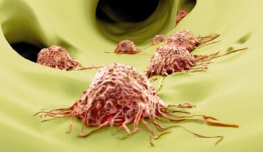 Glucose-fructose mix found in sugary drinks fuels colorectal cancer metastasis