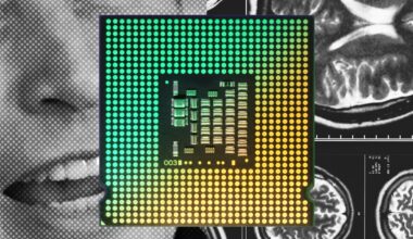 Neuralink, Elon Musk, and the Race to Put Chips Into Our Brains 