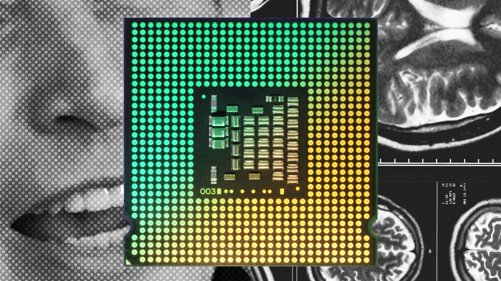 Neuralink, Elon Musk, and the Race to Put Chips Into Our Brains