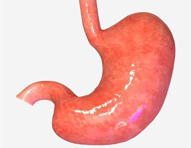 New molecular signatures map the stepwise development of gastric cancer