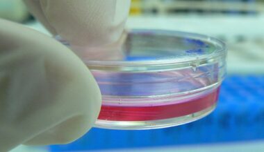 Engineers create designer biobots using human lung cells