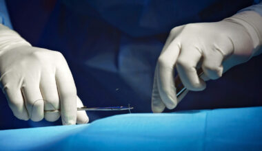 Women Are Now Getting Limb-Shortening Surgery in the Name of Love