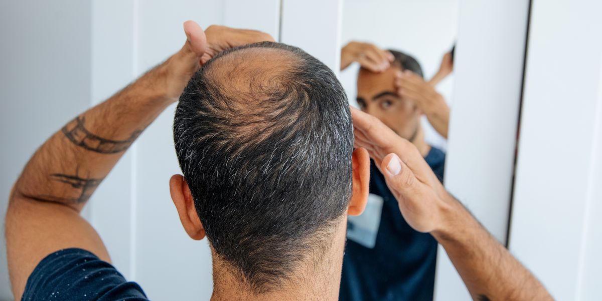 Experimental Drug PP405 May Wake Up Dormant Follicles to Regrow Hair