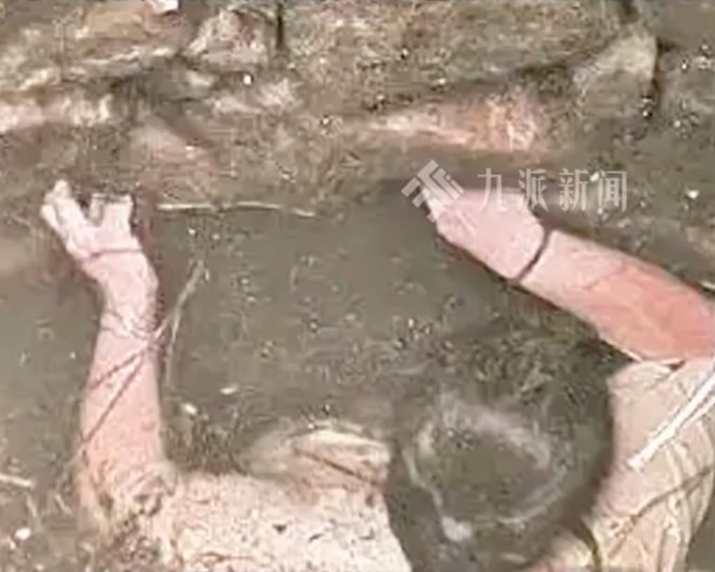 After clinging to the wall for over two days, Qin’s hands experienced severe injuries and ulcerations. Photo: Weibo