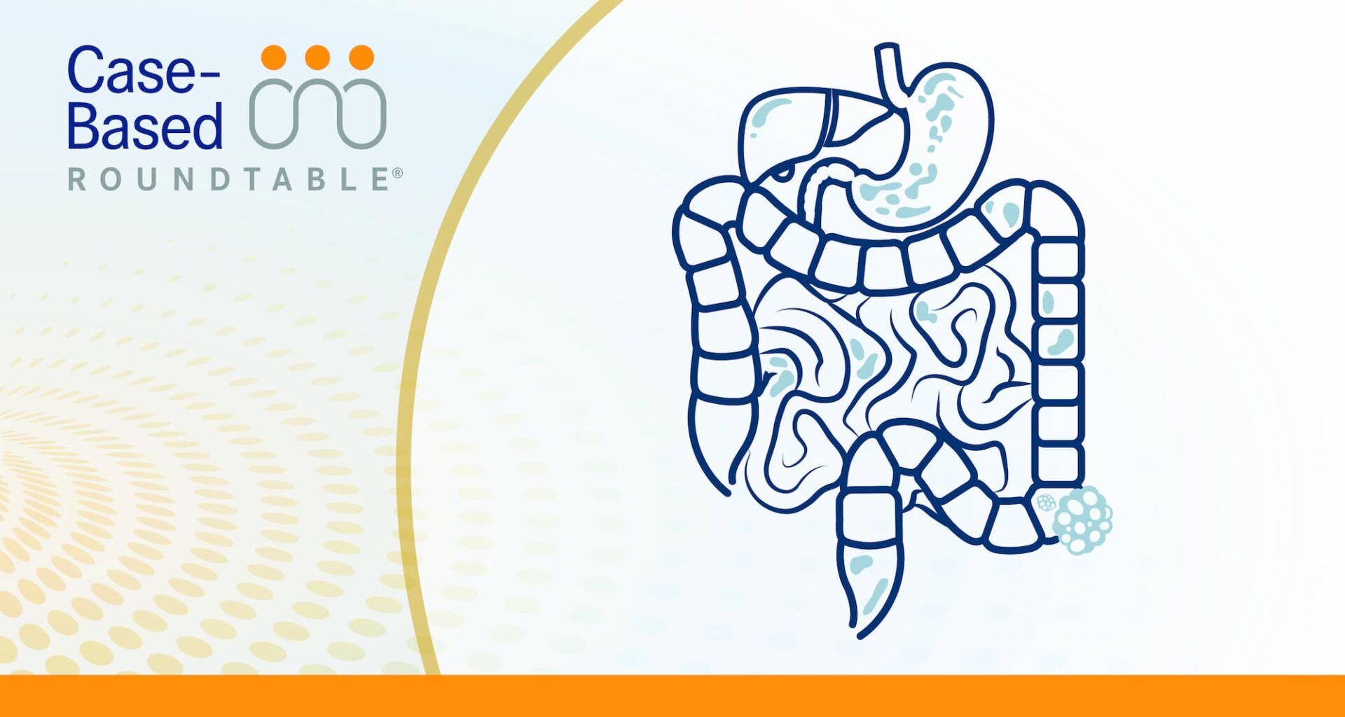 NALIRIFOX Dose Reductions Maintain Efficacy in Pancreatic Cancer