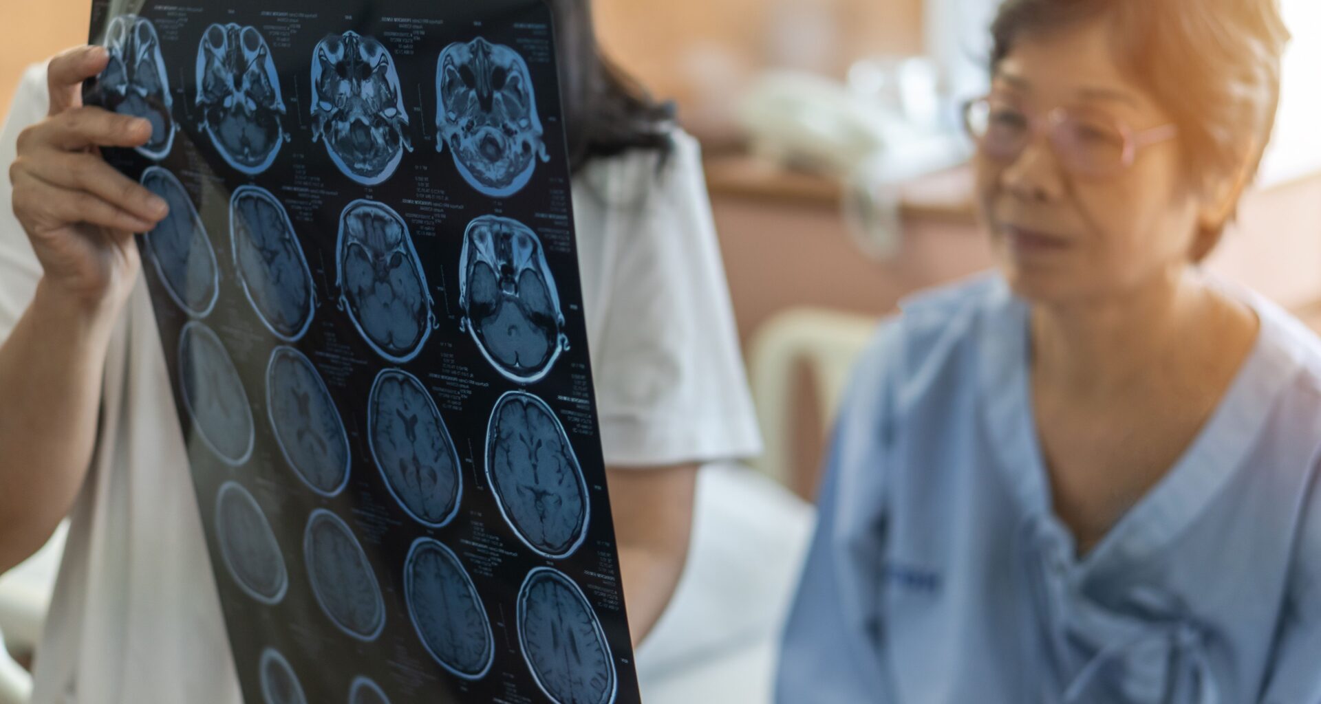 Hysterectomy, oophorectomy linked to raised stroke risk