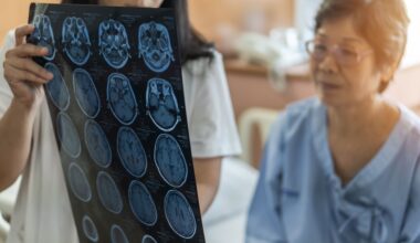 Hysterectomy, oophorectomy linked to raised stroke risk