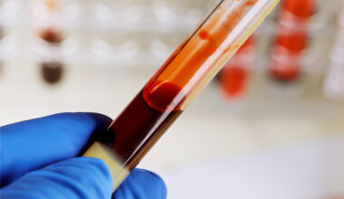 Blood test reads aging organ by organ