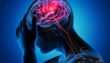 Scientists reverse stroke damage with stem cell therapy