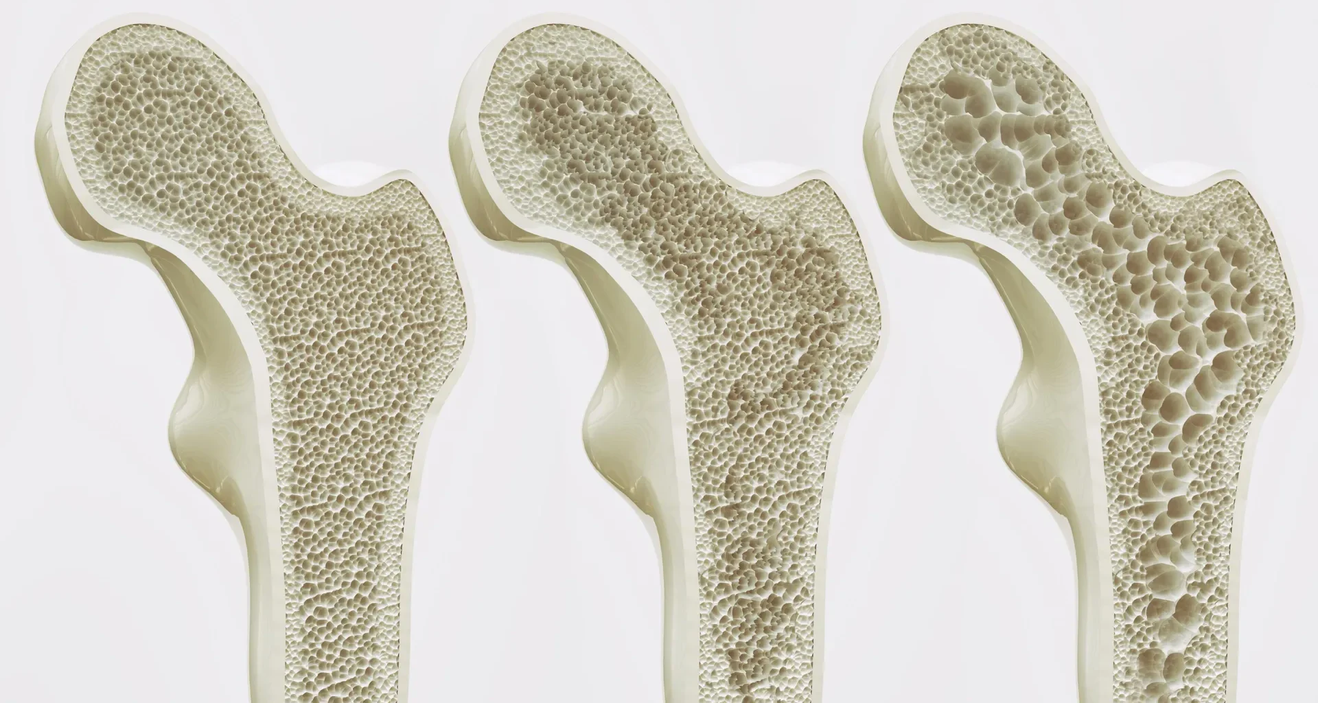 Scientists may have found a way to strengthen bones for life