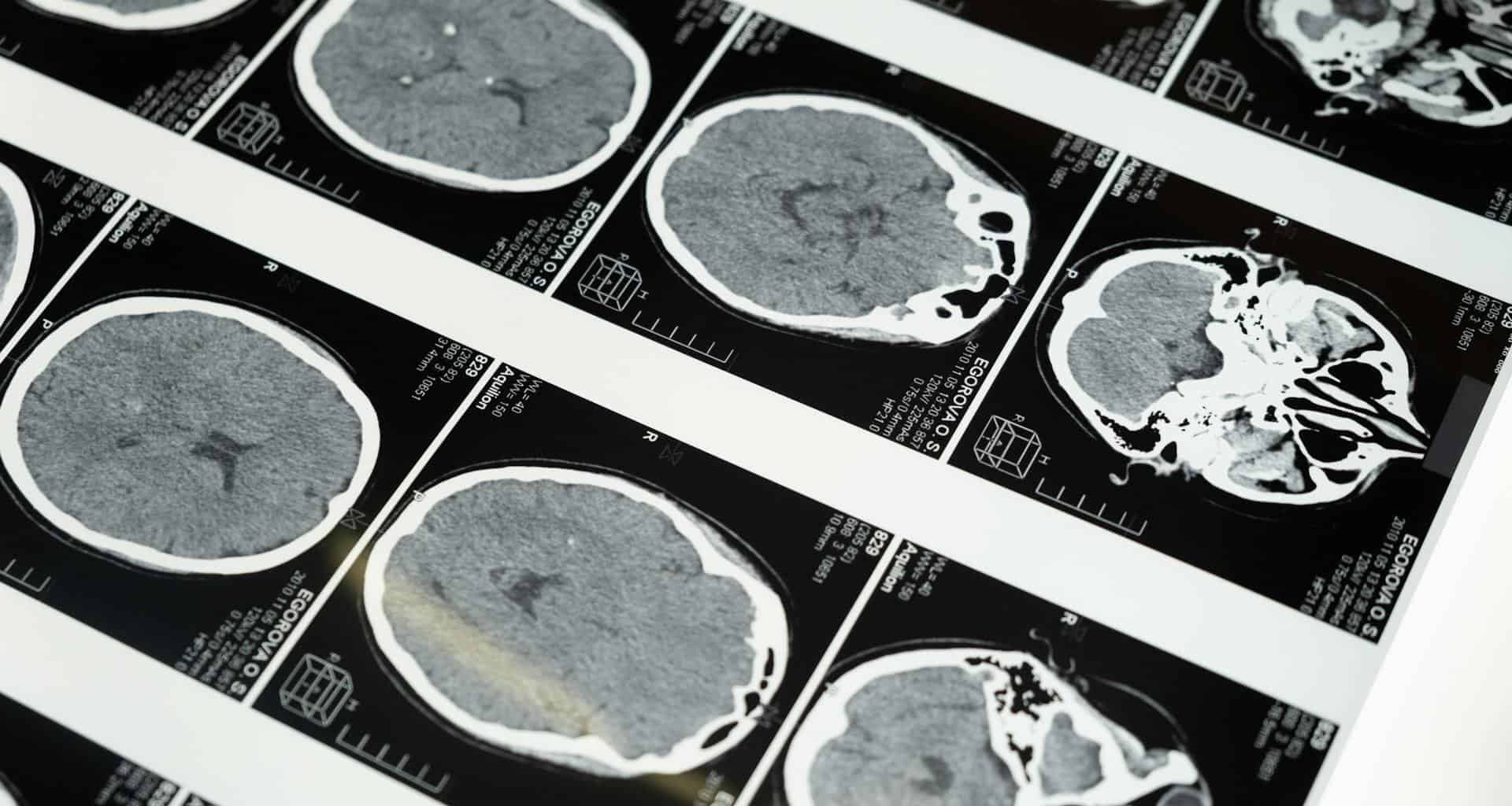 The Crystal Behind Next Gen Solar Panels May Transform Cancer and Heart Disease Scans