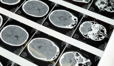 The Crystal Behind Next Gen Solar Panels May Transform Cancer and Heart Disease Scans