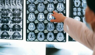 Brain scans show this type of exercise boosts memory and grows the hippocampus