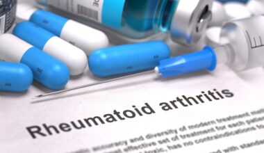New study reveals silent onset of rheumatoid arthritis