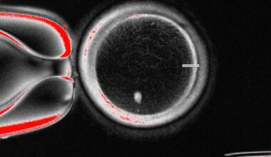 Scientists create fertilizable eggs from human skin cells in proof-of-concept experiment