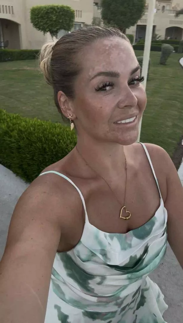 Abbie is now a weight-loss coach (Jam Press)