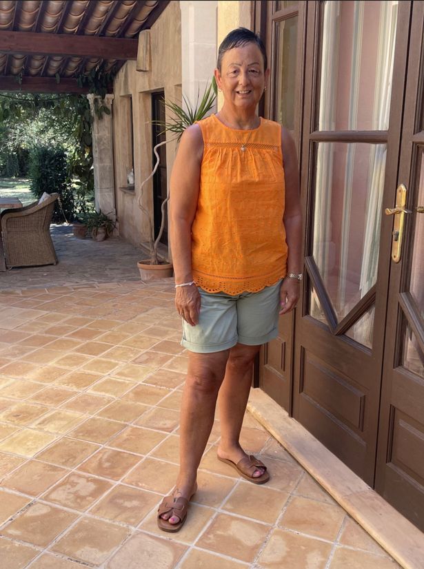 Beverley endured a nightmare holiday with a broken pelvis