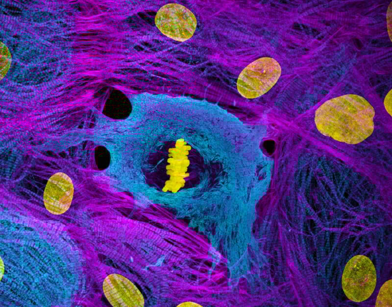 Colorful microscopic image showing yellow oval shapes, a central blue and black circular area with a bright yellow structure inside, all surrounded by a pink and purple fibrous network.