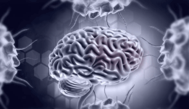 Neurologist explains the silent force behind heart and stroke risk
