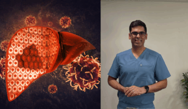 Doctor suggests 5 signs of fatty liver one can check at home