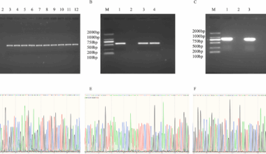 Characterization and transmission dynamics of carbapenemase-encoding genes in carbapenem-resistant Enterobacter cloacae isolated from eight teaching hospitals in Guangdong province, China (2022–2024) | BMC Microbiology