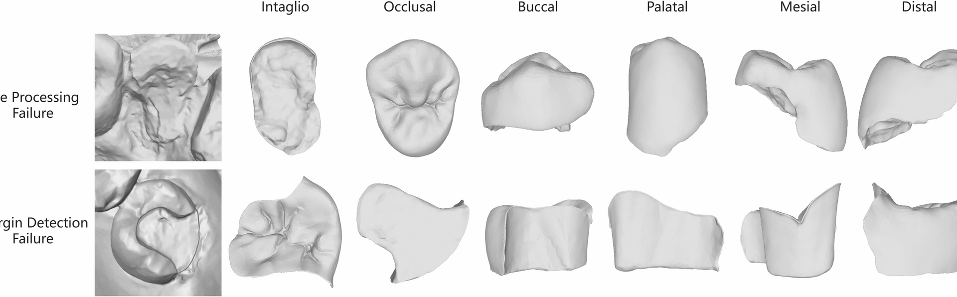 Morphological comparison between artificial intelligence-driven and manual CAD design in single tooth restoration: a preliminary study | BMC Oral Health