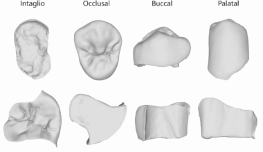 Morphological comparison between artificial intelligence-driven and manual CAD design in single tooth restoration: a preliminary study | BMC Oral Health