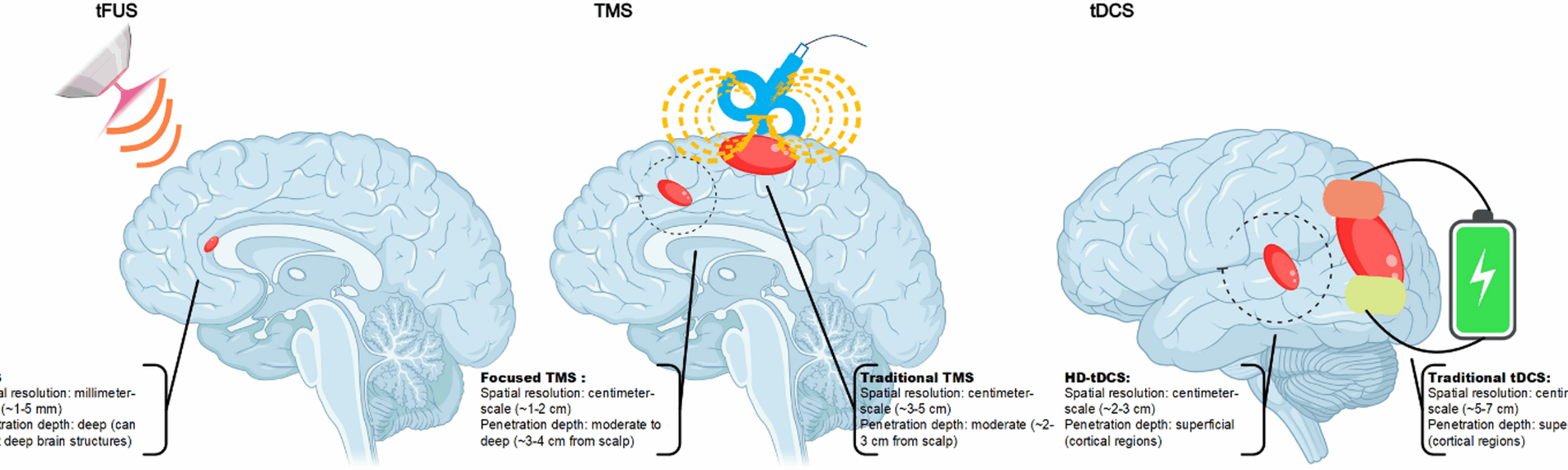 A panoramic review of transcranial focused ultrasound neuromodulation: from basic research to clinical applications | Journal of NeuroEngineering and Rehabilitation