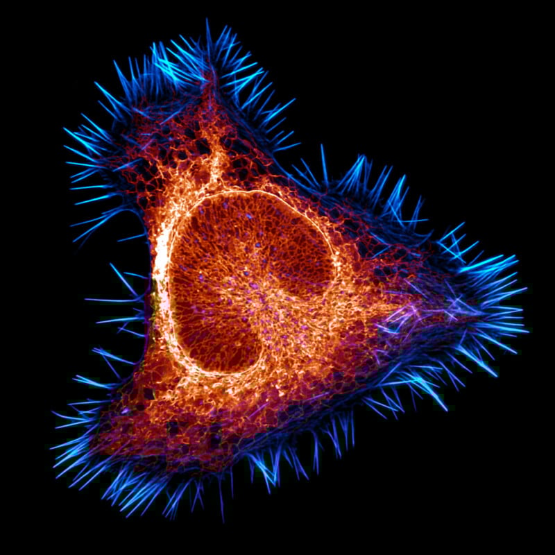A triangular-shaped cell with a bright orange center and network, surrounded by blue, spiky structures radiating outward against a black background.
