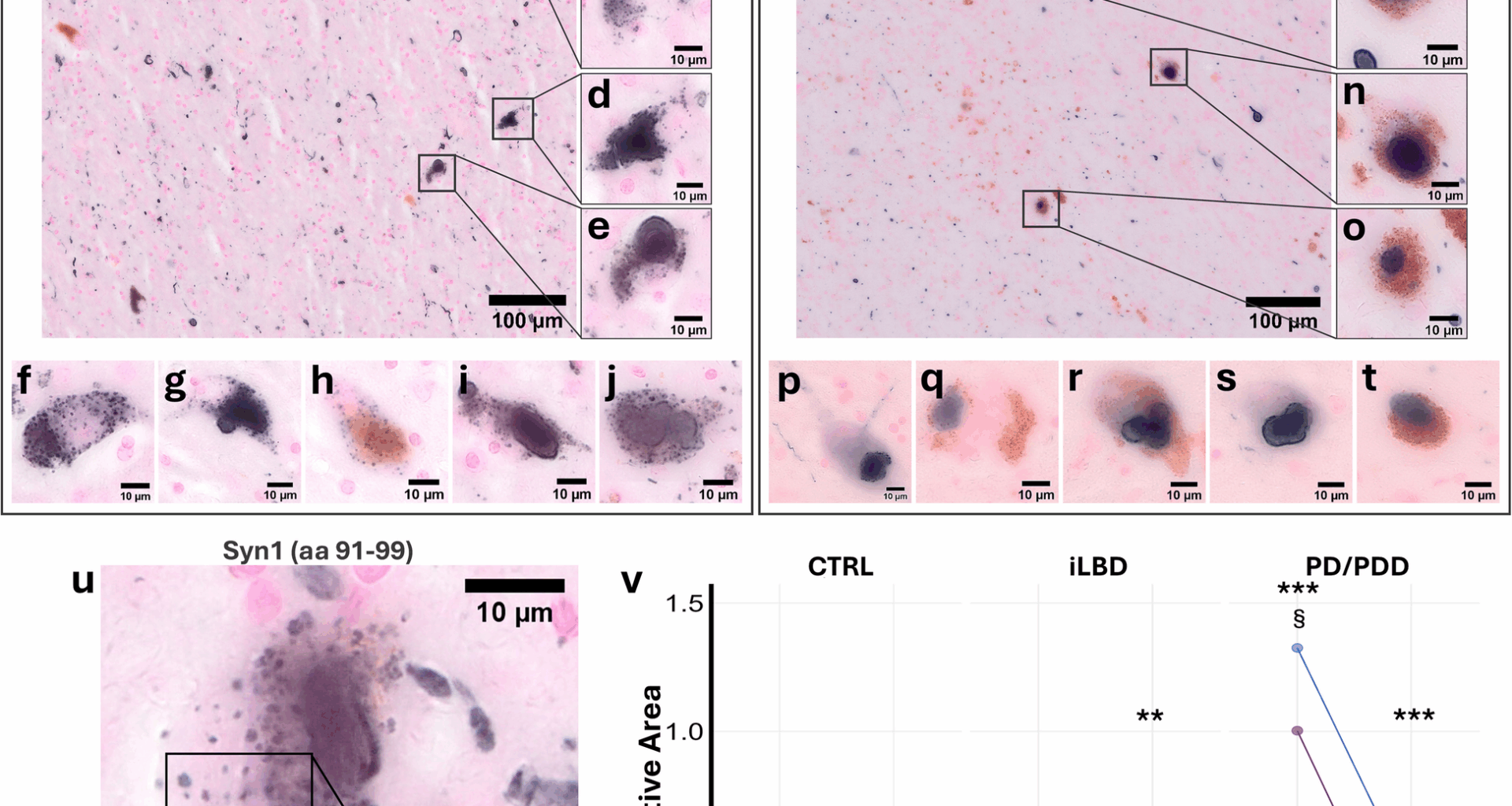 C-terminus-dependent detection of lysosomal alpha-synuclein in nigral Parkinson’s disease human brain neurons | Molecular Neurodegeneration