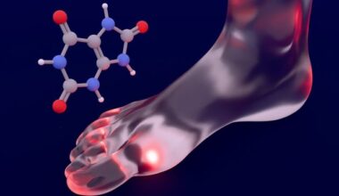 Stay Well: I’ve been diagnosed with gout – what is it and can I get rid of it?