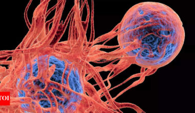 Rectal bleeding linked to 850% higher risk of colorectal cancer in adults under 50