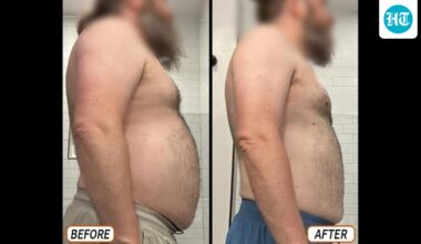 Man loses 20 kg, 6.5 inches off his waist in 90 days without cardio: ‘No snacking, eating 3 hours before bed’