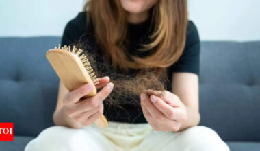 Oral minoxidil: The affordable hair loss solution you didn't know you needed