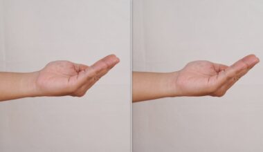 Viral Dementia Exercises: What A Neurologist Thinks