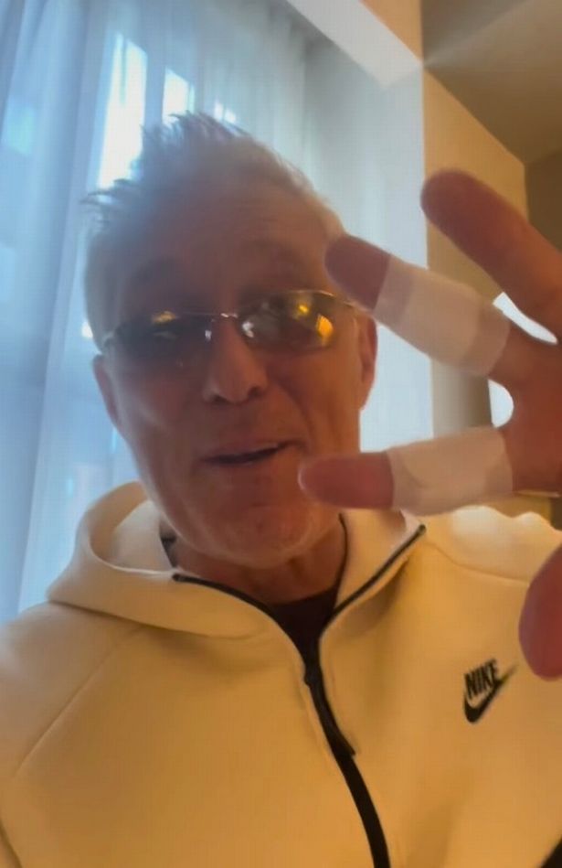 The star showed off his bandaged fingers