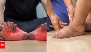 Early symptoms of lung cancer that show up in your legs and feet: Swelling, pain, and colour changes to watch for |