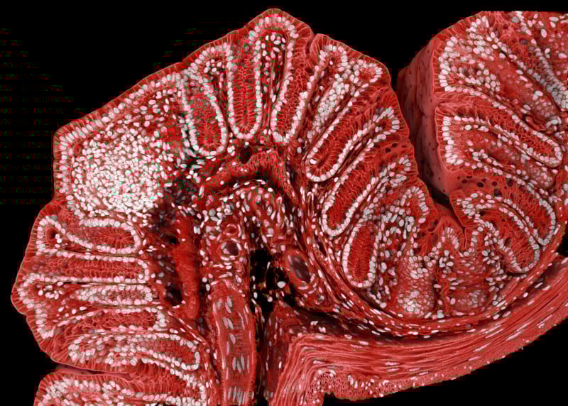 Cross-section of red and white tissue with intricate folds and layers, resembling the inside of the small intestine, showing detailed cellular structures and textures against a black background.