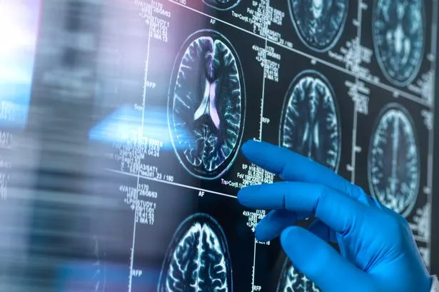 Brain scan