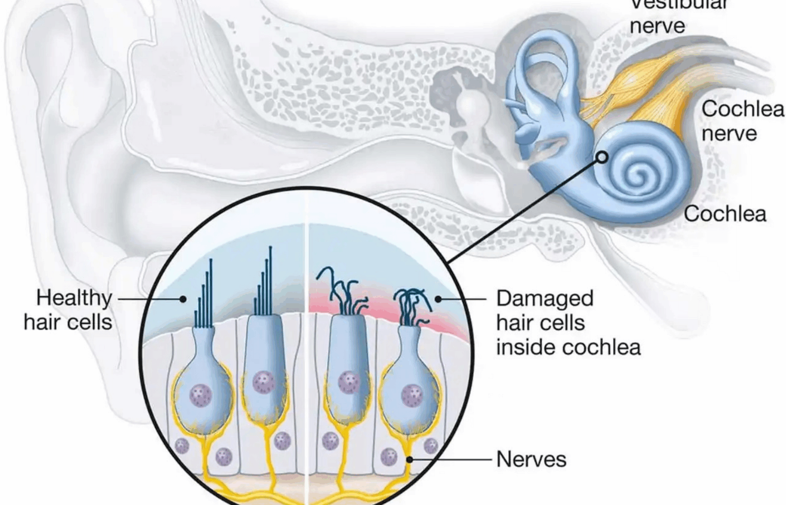 Audiological and radiological diagnosis of sensorineural hearing loss in Africa | Egyptian Journal of Radiology and Nuclear Medicine