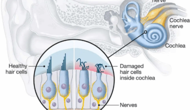 Audiological and radiological diagnosis of sensorineural hearing loss in Africa | Egyptian Journal of Radiology and Nuclear Medicine