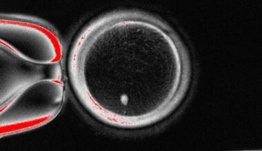 Scientists find way to fertilise eggs made from genetic material of skin cells