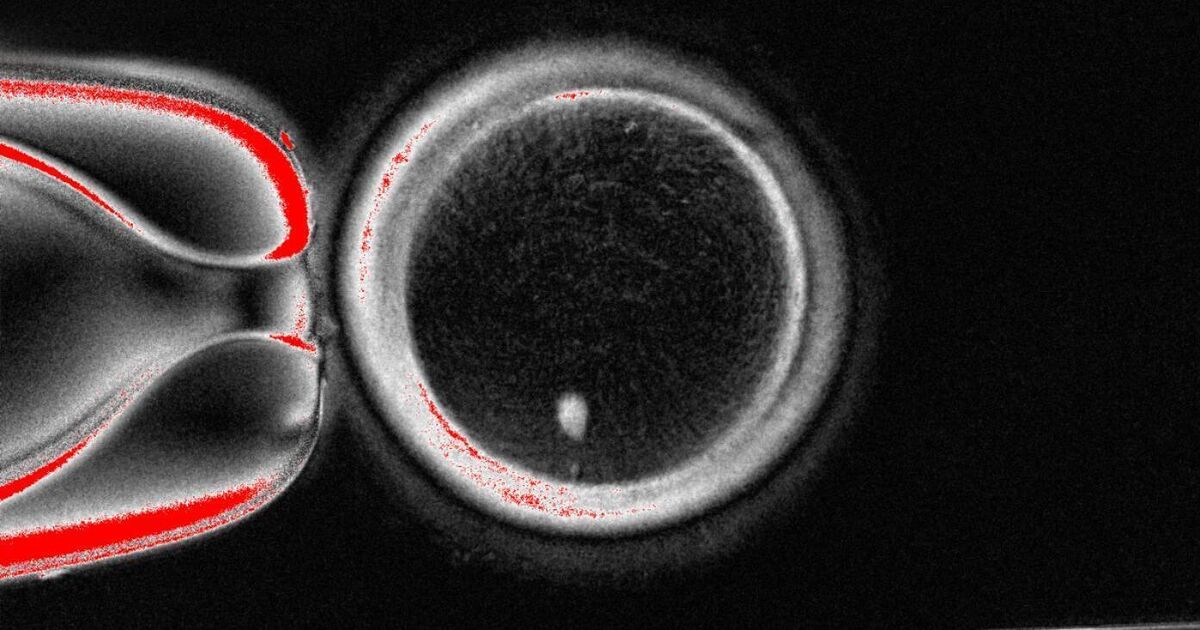 Scientists find way to fertilise eggs made from genetic material of skin cells
