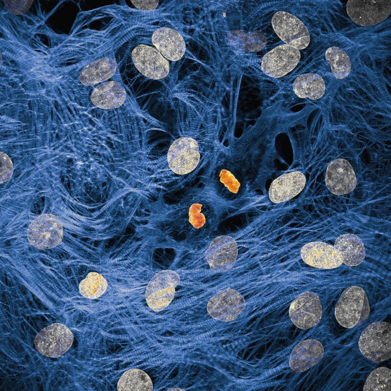 Microscopic image showing numerous oval-shaped cell nuclei (gray) scattered across a web-like blue extracellular matrix, with two orange chromosomes visible near the center.