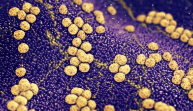PCR boosts detection of bacteria in pediatric bone and joint infections