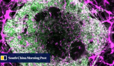 Breakthrough in lab-grown mini-organs shows promise for disease study